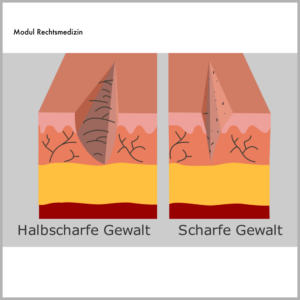 Medizinillustratione für die Charite Berlin, Projekt Sympol