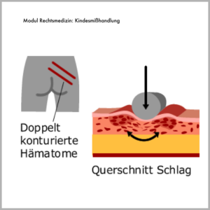 Medizinillustratione für die Charite Berlin, Projekt Sympol