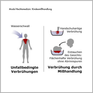 Medizinillustratione für die Charite Berlin, Projekt Sympol