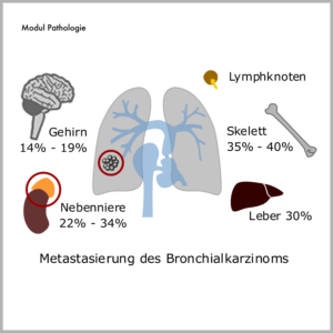 Medizinillustratione für die Charite Berlin, Projekt Sympol